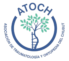 ATOCH